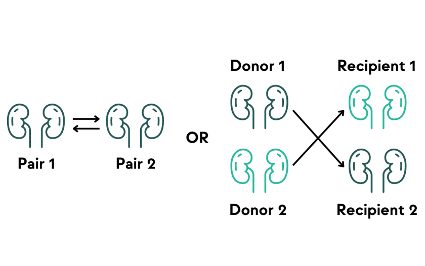 kidney exchange diagram